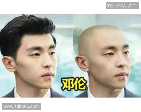 足球明星剃光头震撼亮相引热议，粉丝纷纷猜测背后原因和未来发展